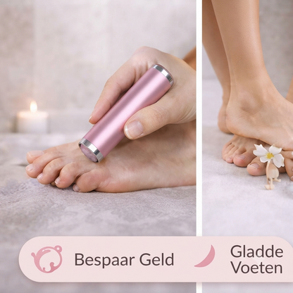 VelvetyFeet elektrische eeltverwijderaar - foto 5