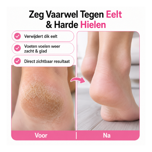 VelvetyFeet elektrische eeltverwijderaar - foto 4