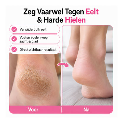 VelvetyFeet elektrische eeltverwijderaar - foto 4
